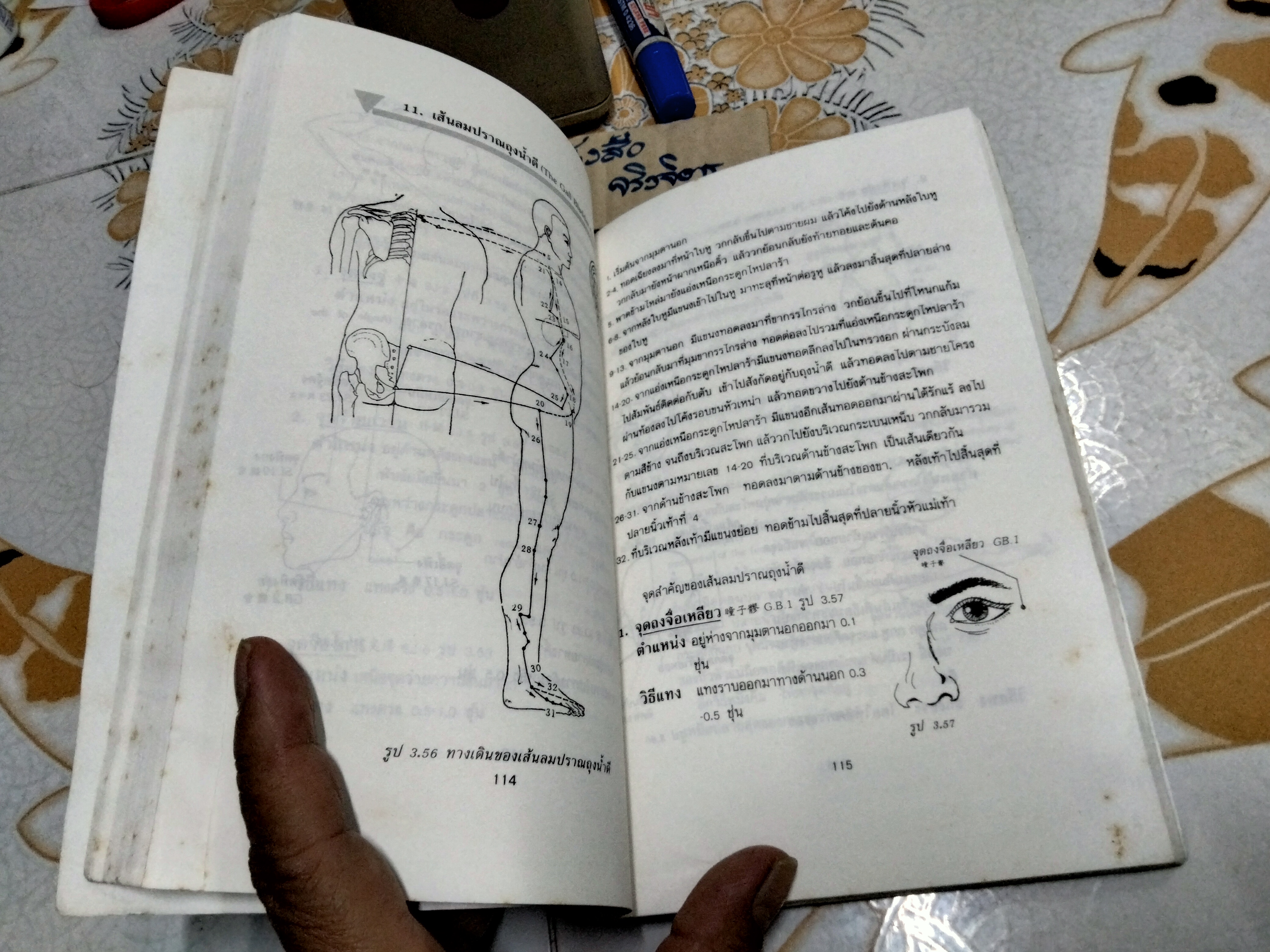 แทงเข็ม - คู่มือที่ให้ความรู้เรื่องการแทงเข็มขั้นพื้นฐานอย่างสมบูรณ์ที่สุด โดย อภิชัย ชัยดรุณ , วิทวัส วัณนาวิบูล และ เผด็จ เอี่ยมแสงธรรม **สินค้าหมด**