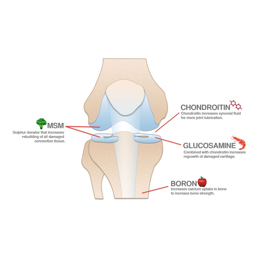 Doctor's Best® MSM with OptiMSM, The World's Purest MSM 1,000mg 180 Capsules บำรุงข้อต่อและเอ็น เพื่อผมผิวเล็บแข็งแรง