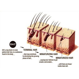 21st Century® Saw Palmetto 450 mg สารสกัดซอว์ปาลเมตโต้