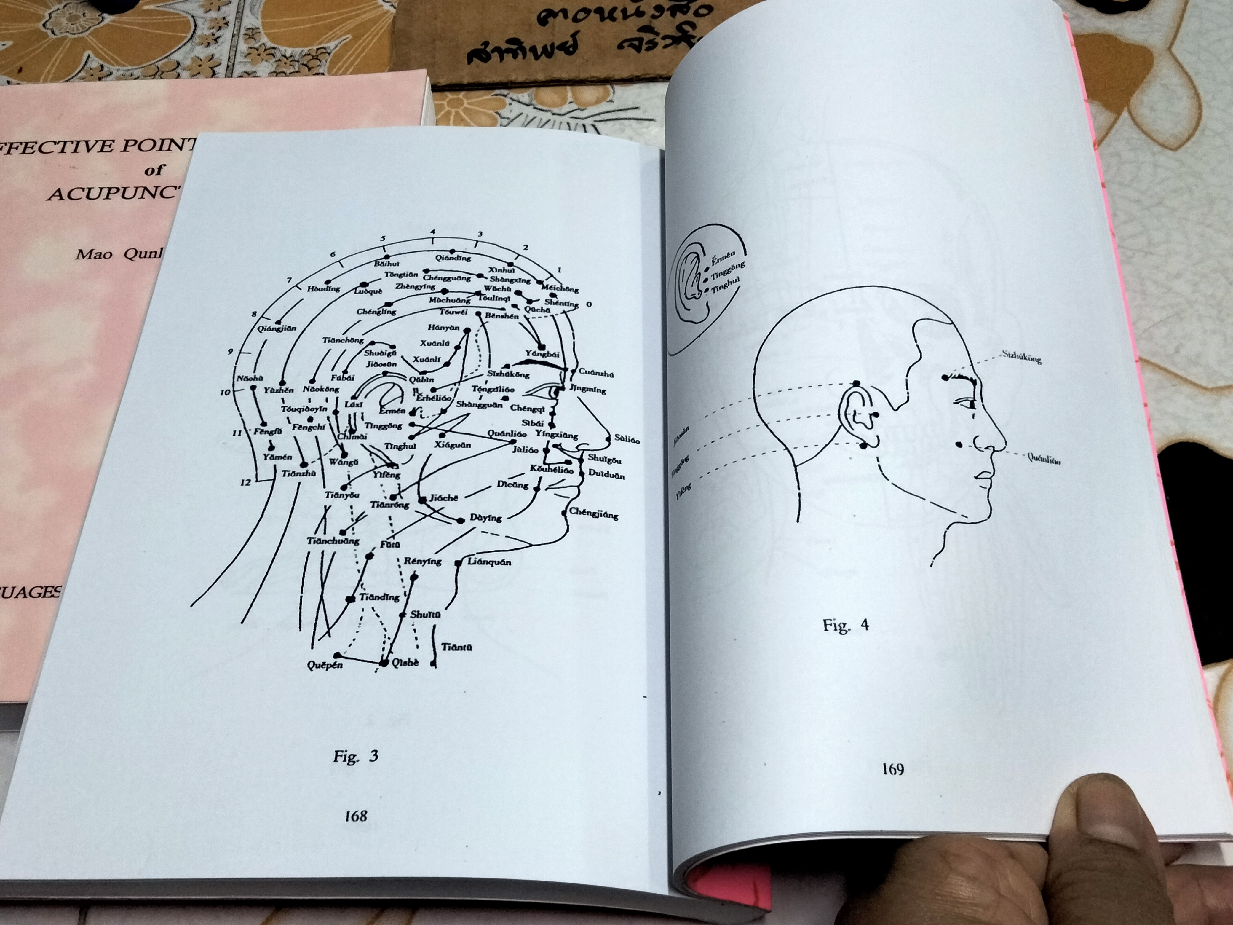 หนังสือเกี่ยวกับการแพทย์แผนจีน- การฝังเข็ม (ภาษาอังกฤษ /ฉบับถ่ายเอกสาร) Effective Points Therapy of Acupuncture , Mao Qunhui + 100 Diseases Treated by Single Point of Acupuncture and Moxibustion , Chen Decheng **สินค้าหมด**