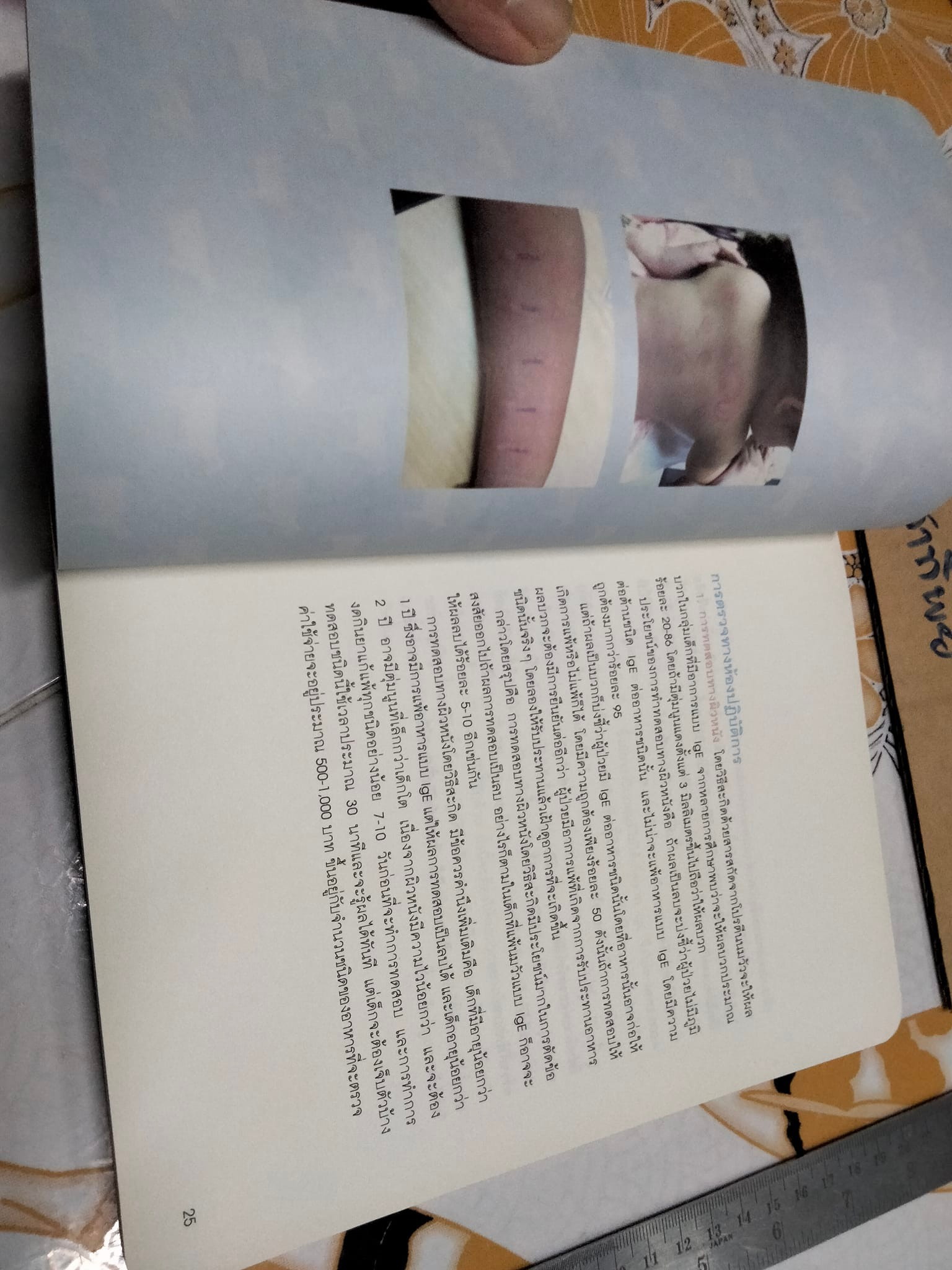 รวมความรู้เรื่องแพ้นมวัว รองศาสตราจารย์ แพทย์หญิงจรุงจิตร์ งามไพบูลย์ **สินค้าหมด**