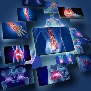 Doctor's Best® Synergistic Glucosamine MSM Formula with OptiMSM® 180 Veggie Caps กลูโคซามีน ซัลเฟต คอนดรอยติน และซัลเฟอร์