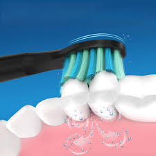 Fairywill® Black Soft Replacement Toothbrush Heads x4 หัวแปรงสีฟันไฟฟ้า สีดำ ขนแปรงไนลอนดูปองท์ ทำความสะอาดฟัน เหงือกอย่างทั่วถึงแม้บริเวณที่เข้าถึงยาก