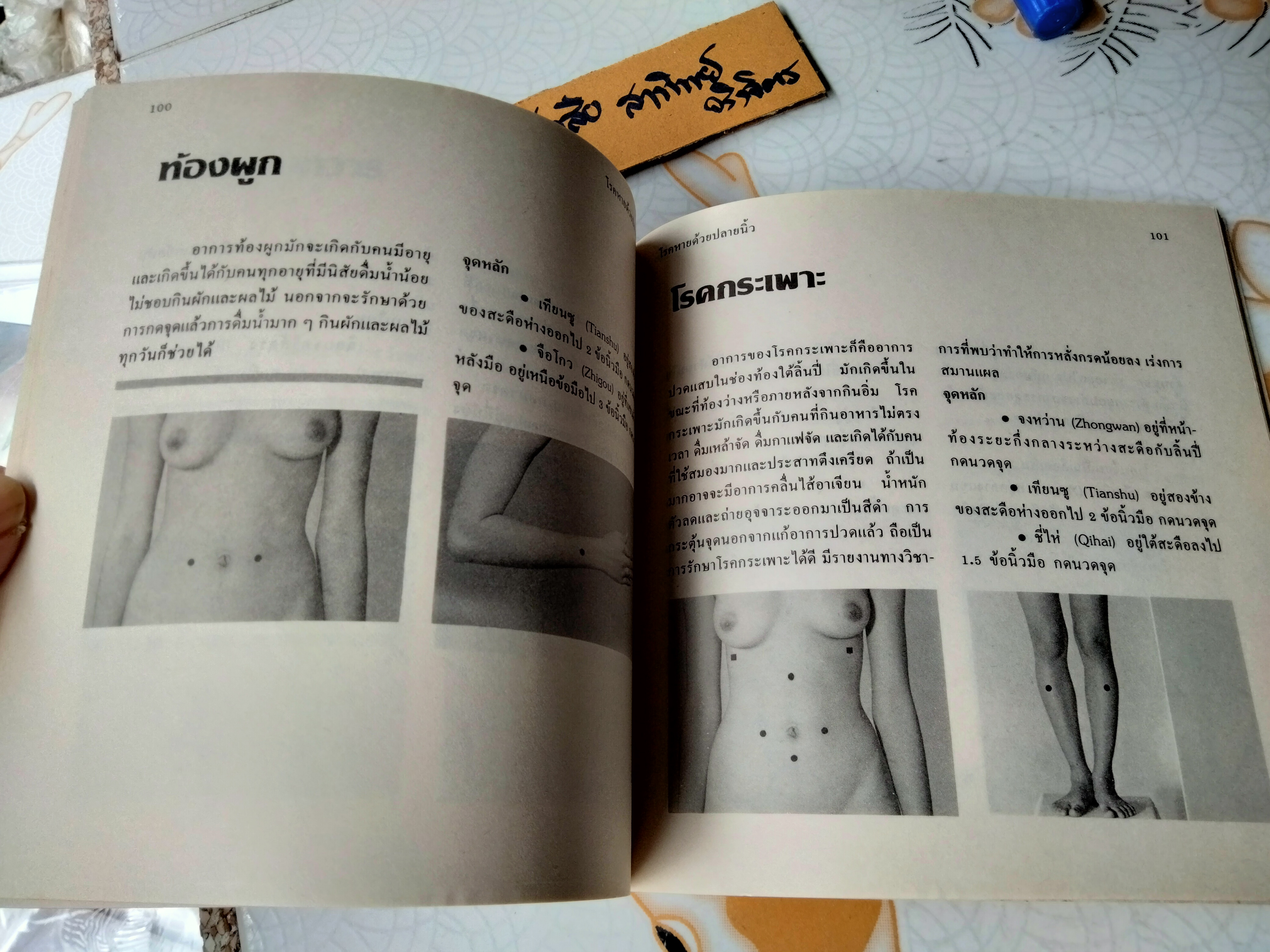 โรคหายด้วยปลายนิ้ว พญ.ณัฏฐา ชุณหสวัสดิกุล , นพ.บรรจบ ชุณหสวัสดิกุล พิมพ์ครั้งที่ 5/2531