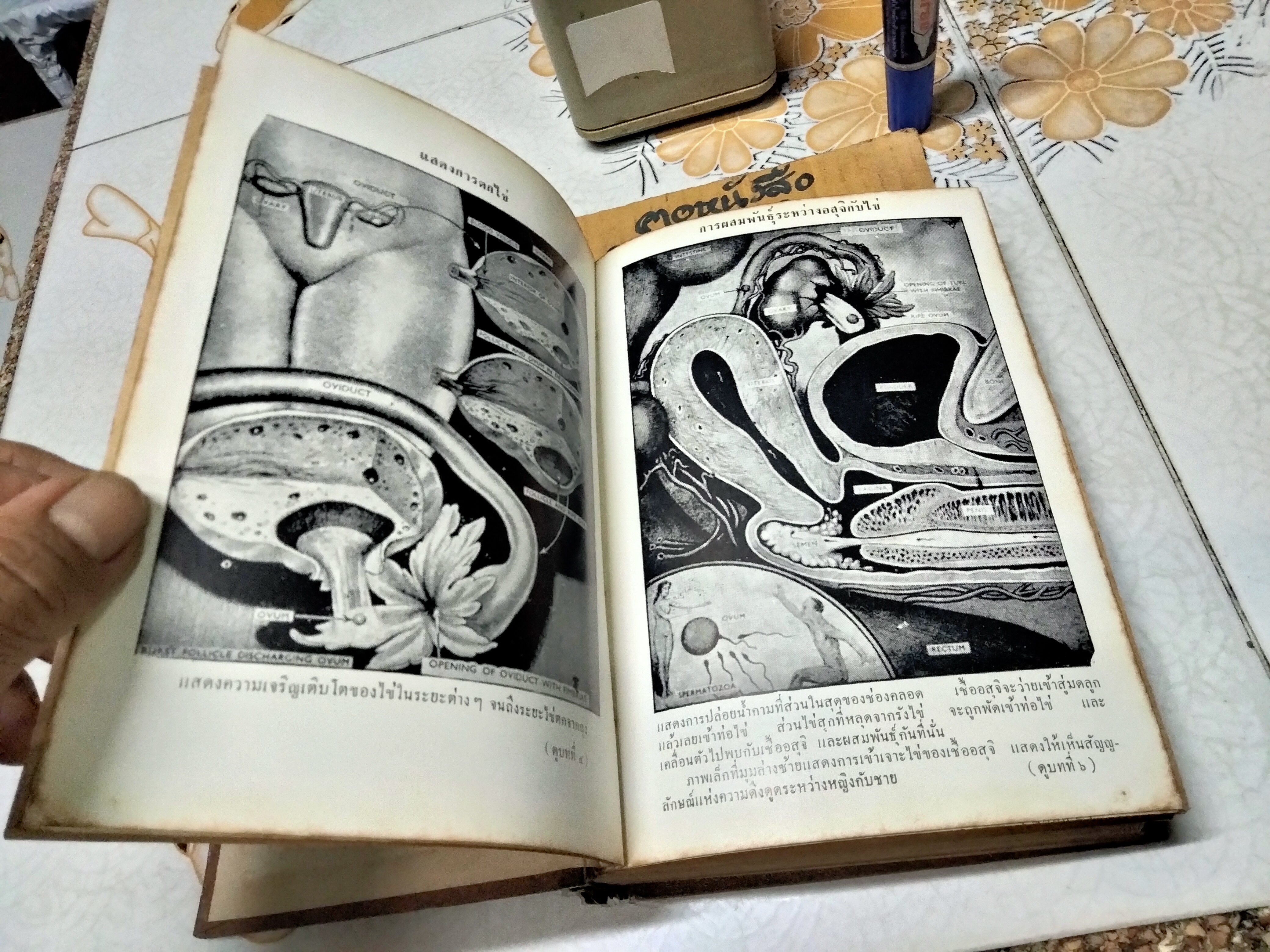 ไขปัญหา ความลับระหว่างเพศ โดย นายแพทย์บุตร ประดิษฐวณิช พิมพ์ปีพ.ศ 2504 สำนักพิมพ์ผดุงศึกษา **สินค้าหมด**