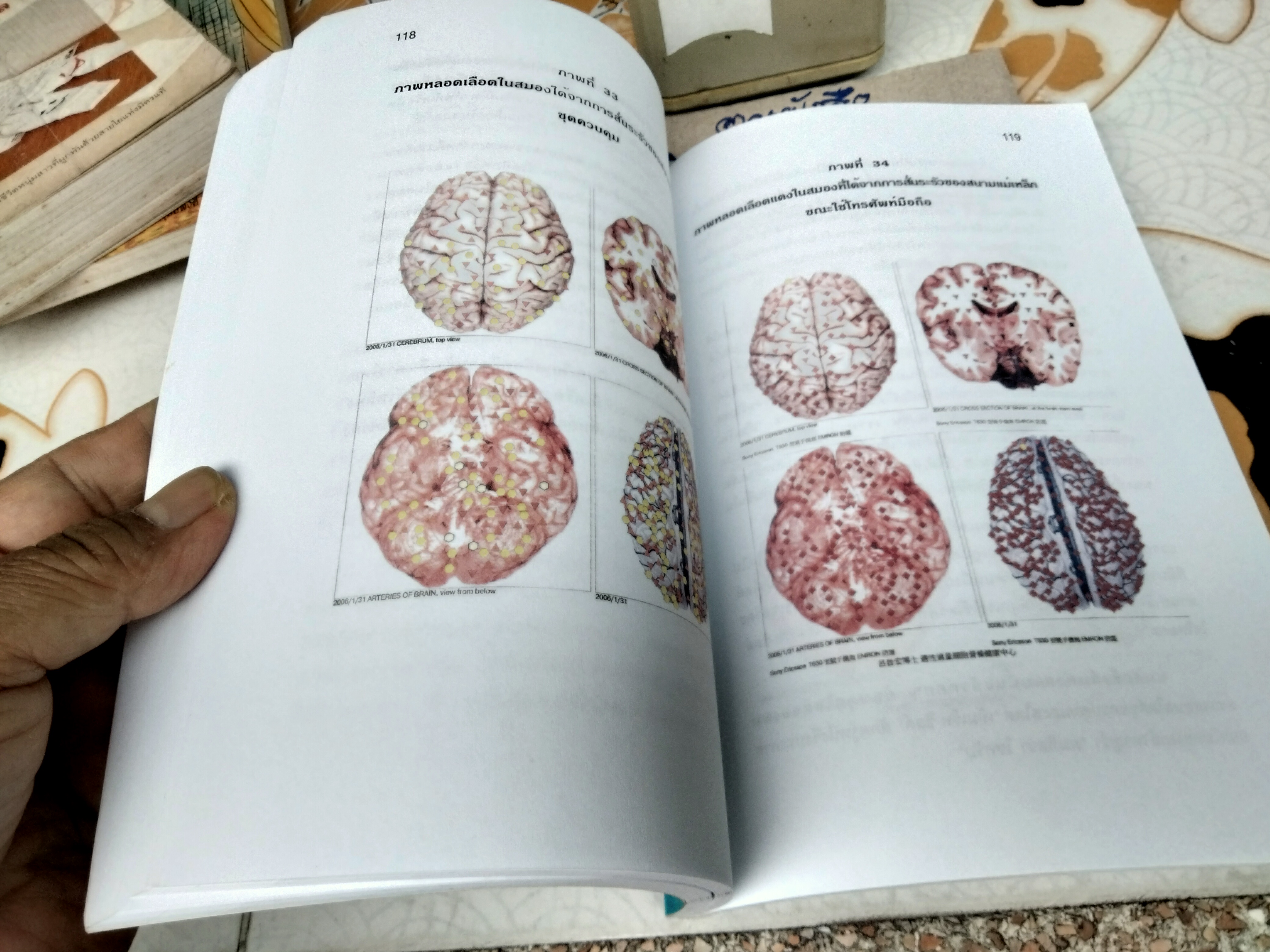 เทคโนโลยีเอ็มเร็ท : ผลดีต่อสรีรวิทยาของมนุษย์ Molecular Resonance Effect Technology : The Dynamic Effects on Human Physiology