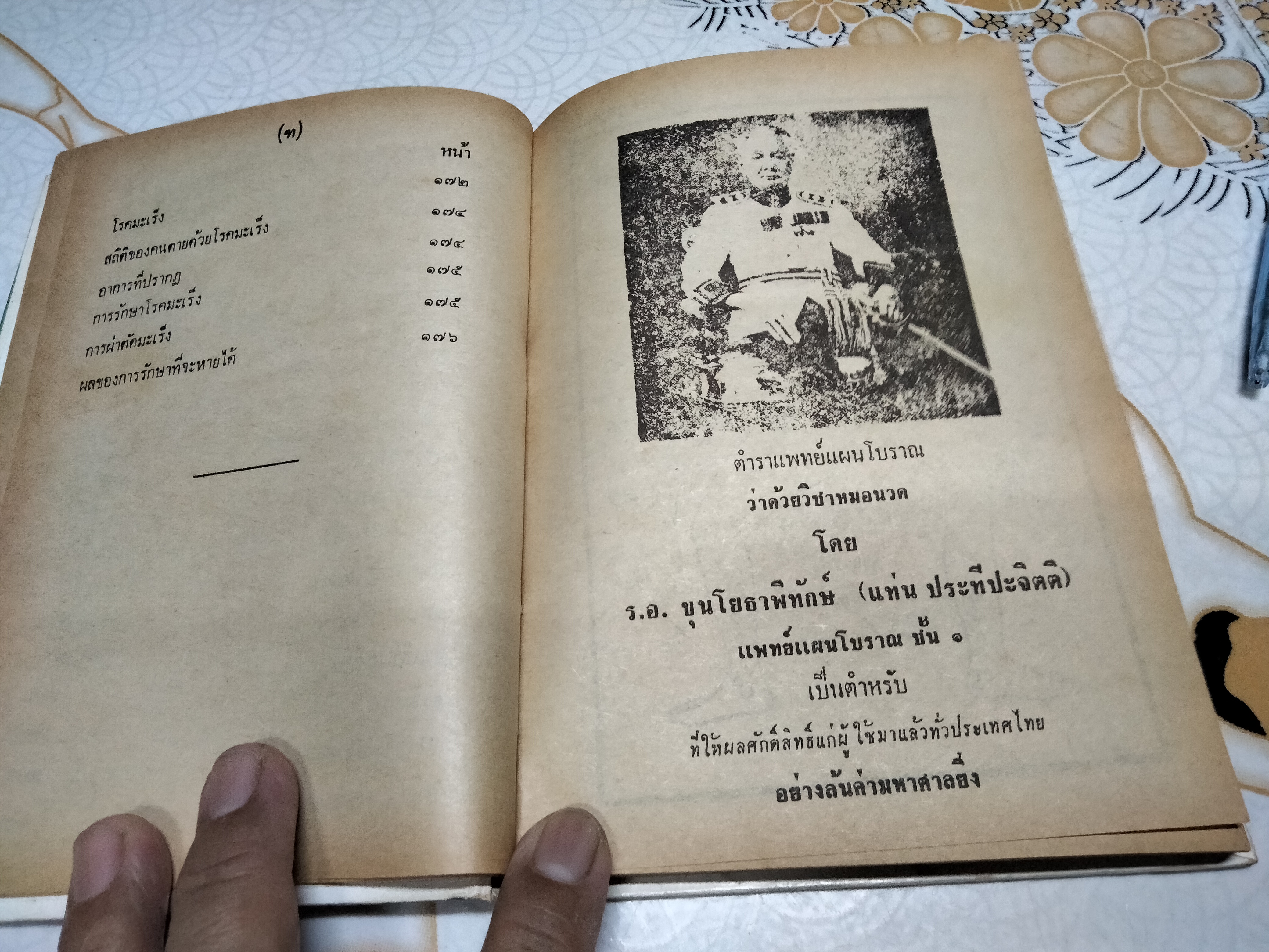 ตำราแพทย์แผนโบราณ ว่าด้วย วิชาหมอนวด รวบรวมโดยร.อ. ขุนโยธาพิทักษ์ (แท่น ประทีปะจิตติ) **สินค้าหมด**