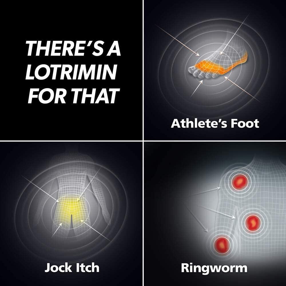 แป้งลดคันจ๊อค คันขาหนีบ ต้นขา แบบสเปรย์ Powder Spray Antifungal Relieves Jock Itch 133g [(Lotrimin®)