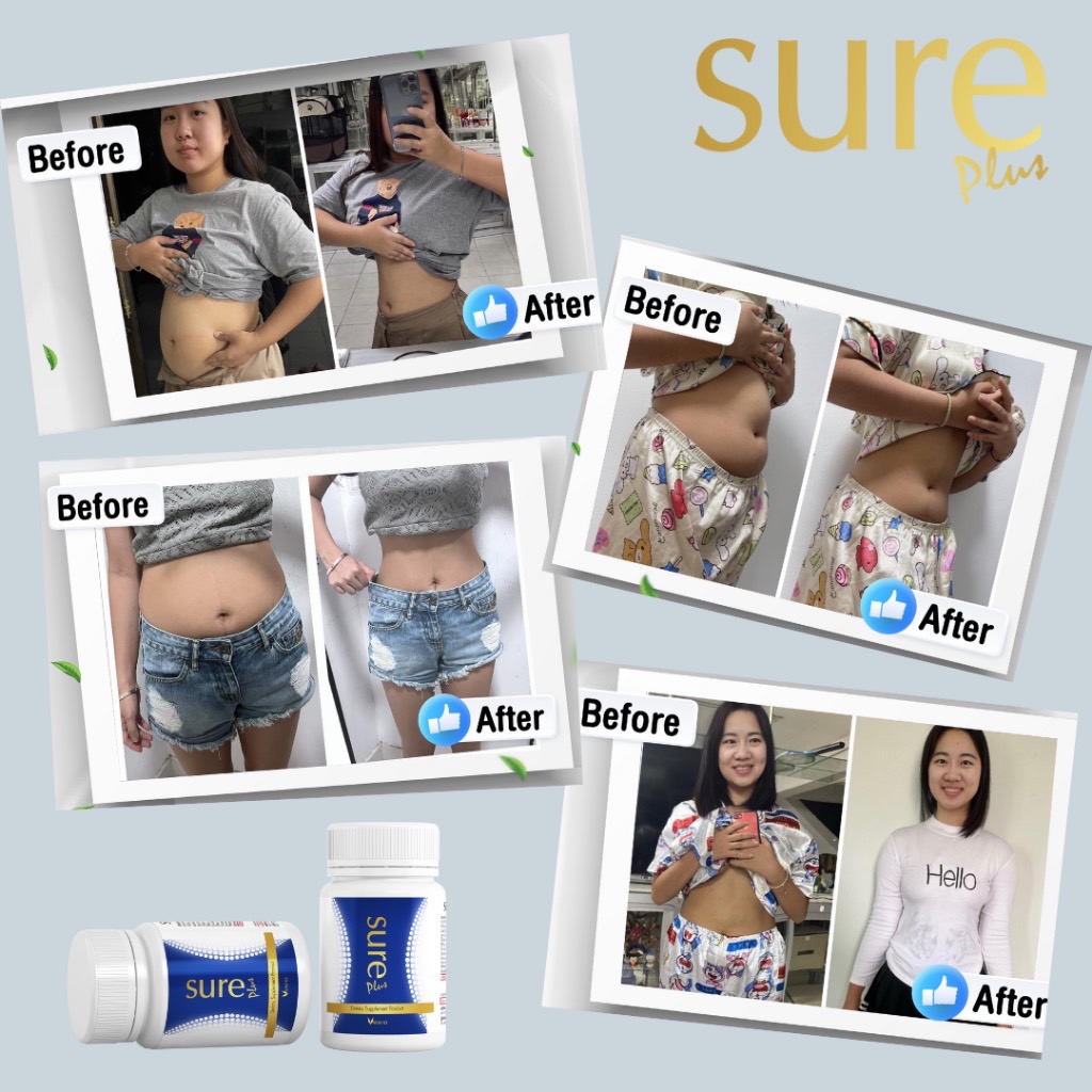 รีวิว sure plus verena