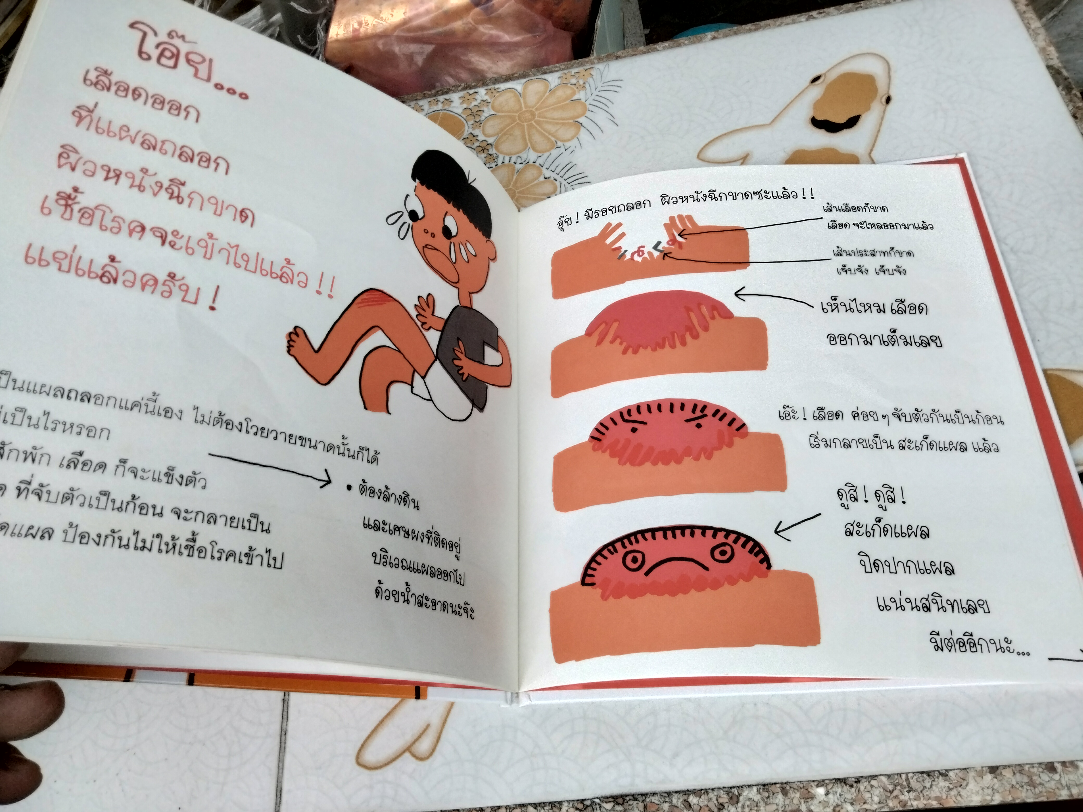 ความลับของสะเก็ดแผล เกนอิชิโร ยางิว (เรื่องและภาพ) มารินา โฮริคาวา (แปล) จากเรื่อง What is a scab? (Kasabuta-kun - ญี่ปุ่น) พิมพ์ครั้งที่ 3/2554 แปลน ฟอร์ คิด