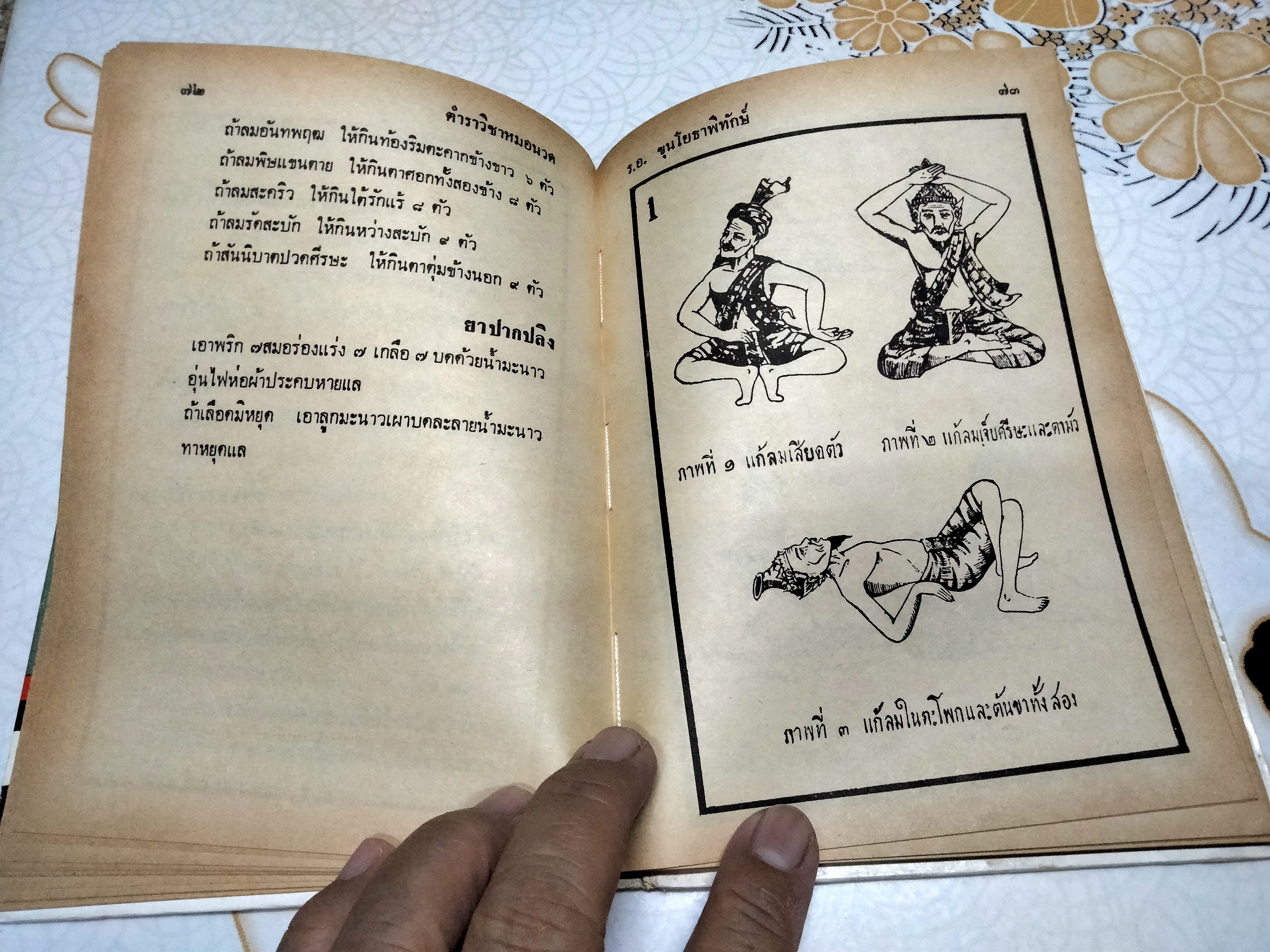 ตำราแพทย์แผนโบราณ ว่าด้วย วิชาหมอนวด รวบรวมโดยร.อ. ขุนโยธาพิทักษ์ (แท่น ประทีปะจิตติ) **สินค้าหมด**