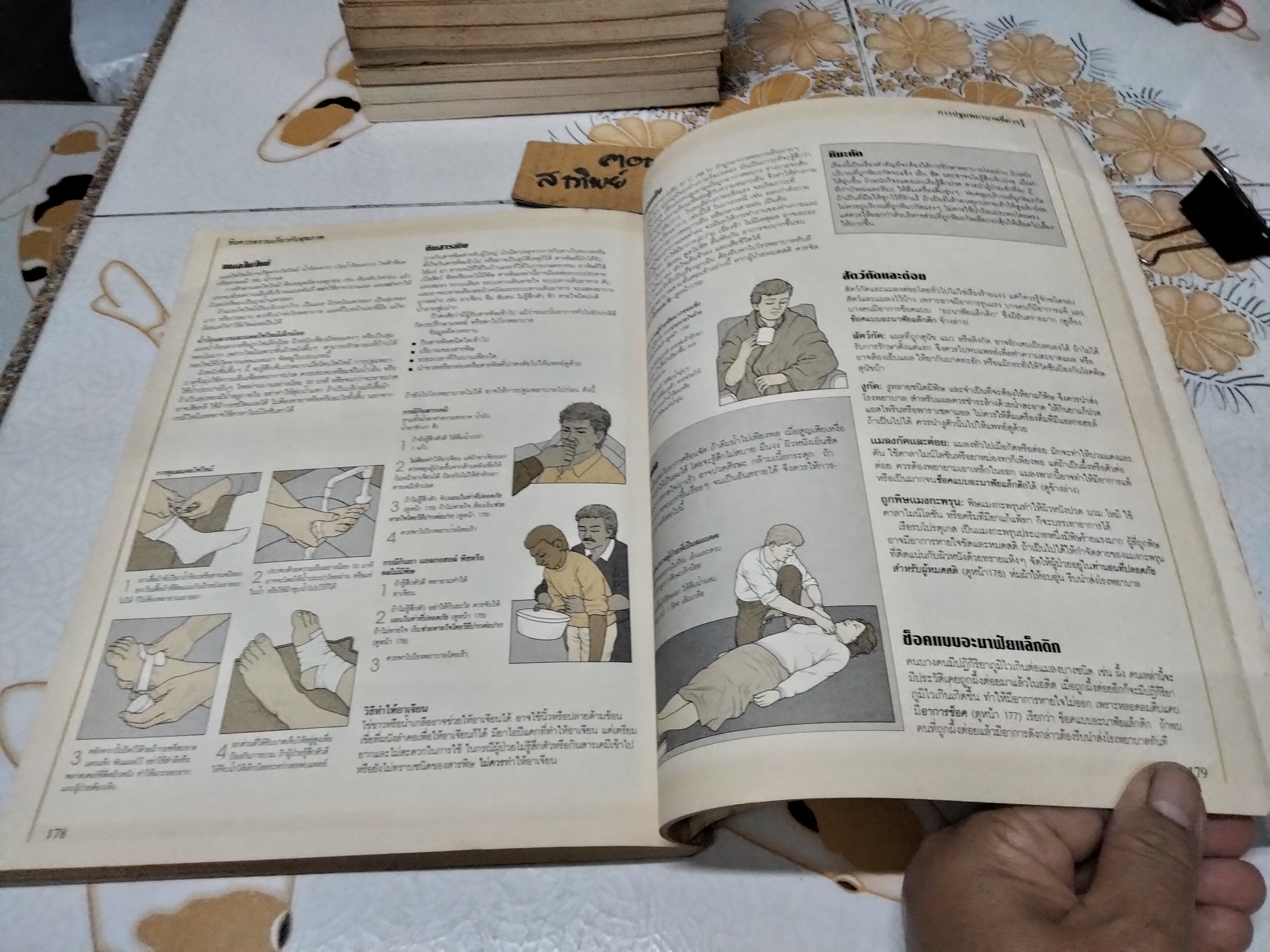 คู่มือสุขภาพประจำบ้าน : เพื่อวินิจฉัยโรคภัยด้วยตนเองก่อนพบแพทย์ คู่มือสุขภาพประจำบ้านเล่ม 2 สำหรับผู้ใหญ่