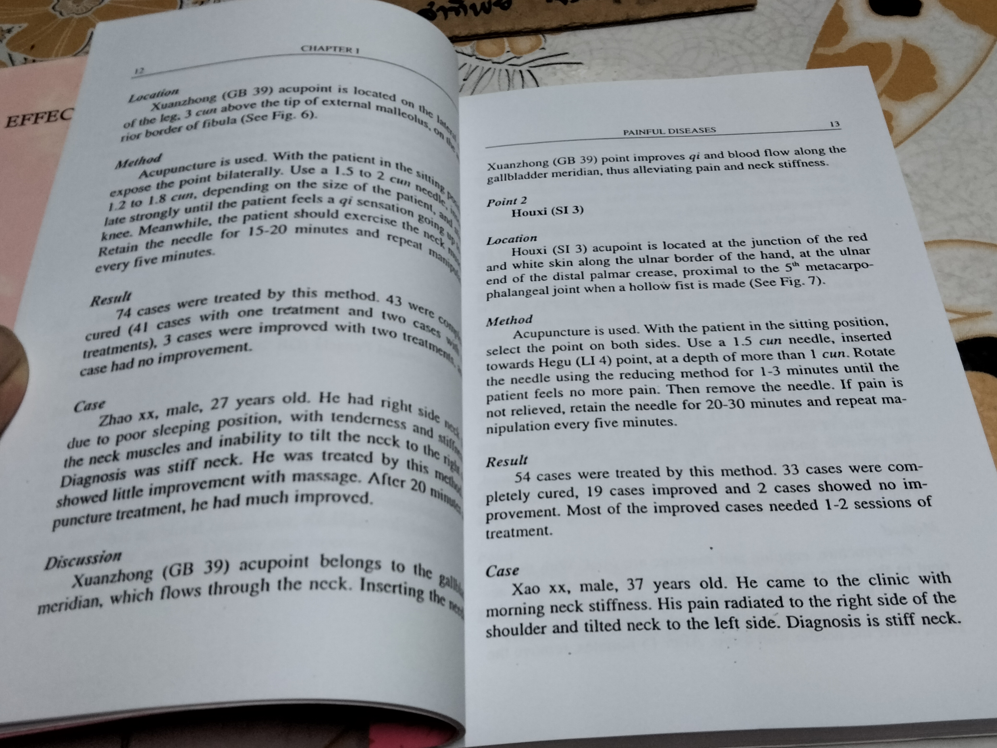 หนังสือเกี่ยวกับการแพทย์แผนจีน- การฝังเข็ม (ภาษาอังกฤษ /ฉบับถ่ายเอกสาร) Effective Points Therapy of Acupuncture , Mao Qunhui + 100 Diseases Treated by Single Point of Acupuncture and Moxibustion , Chen Decheng **สินค้าหมด**