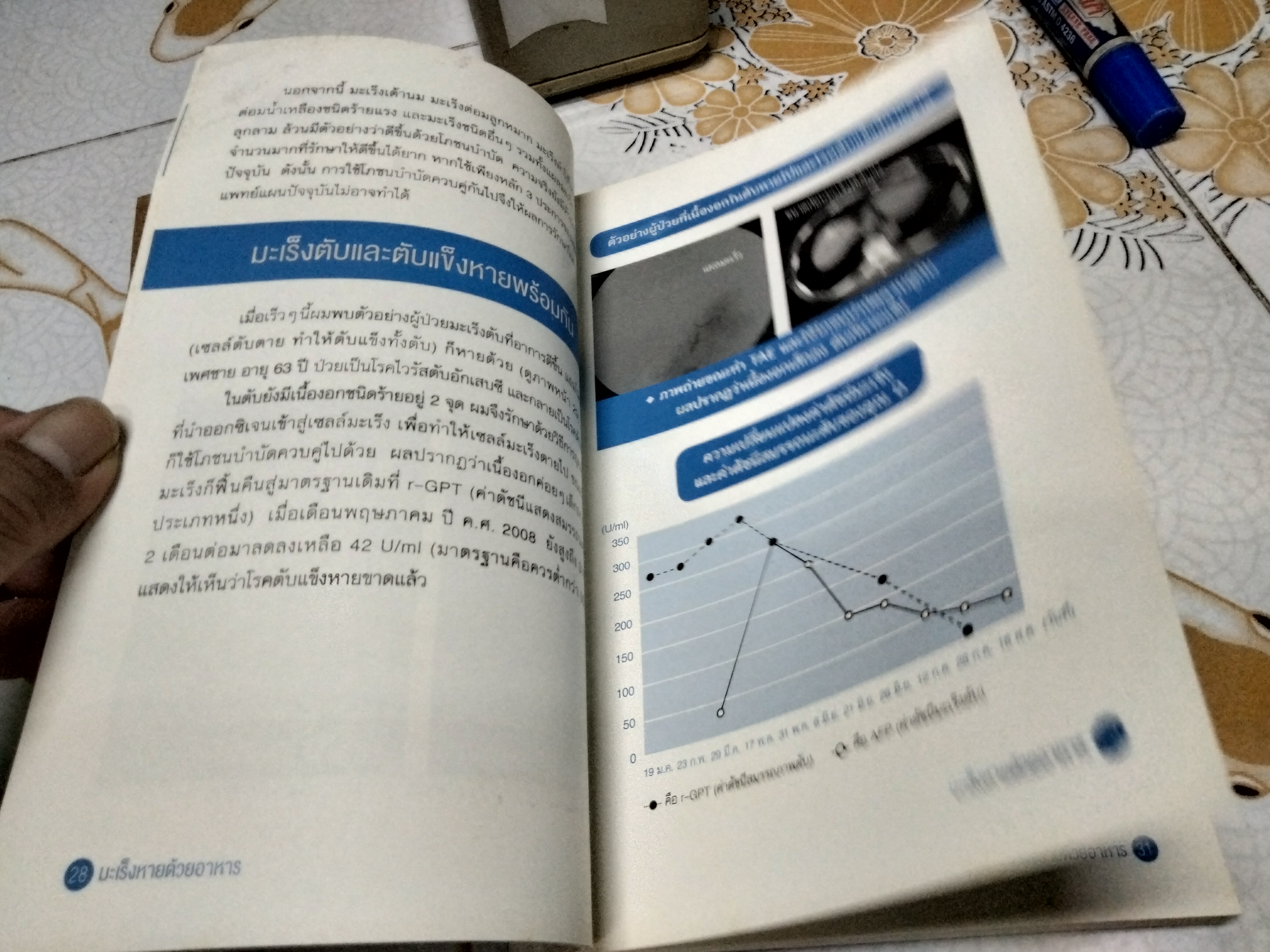 มะเร็งหายด้วยอาหาร โดย Takaho Watayo (ทะกะโฮะ วะตะโย) ชาญ ธนประกอบ แปล , พิมพ์ปี 2560 **สินค้าหมด**