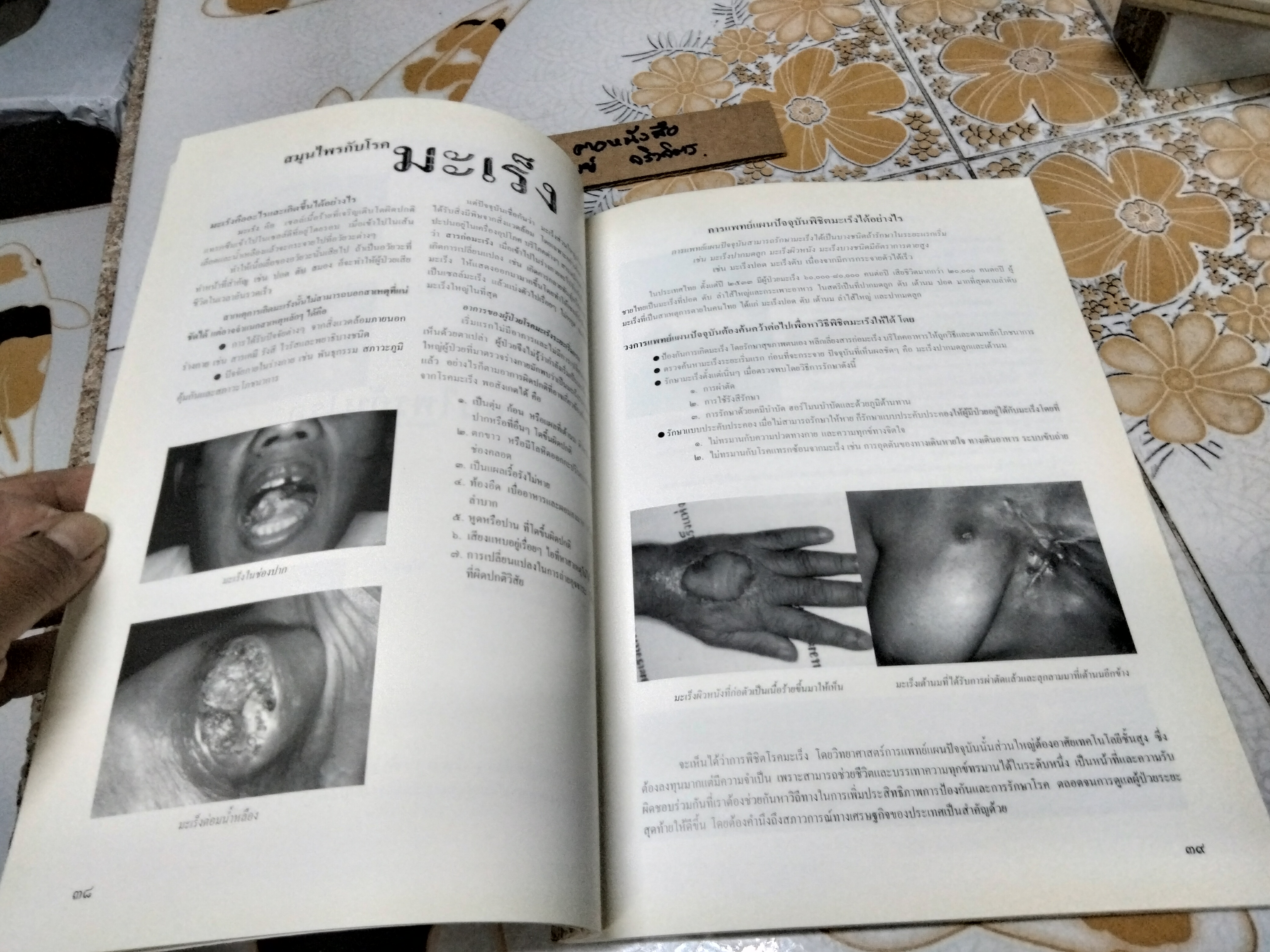 ชุมนุมแพทย์แผนไทย และสมุนไพรแห่งชาติ ครั้งที่ 2 /2541