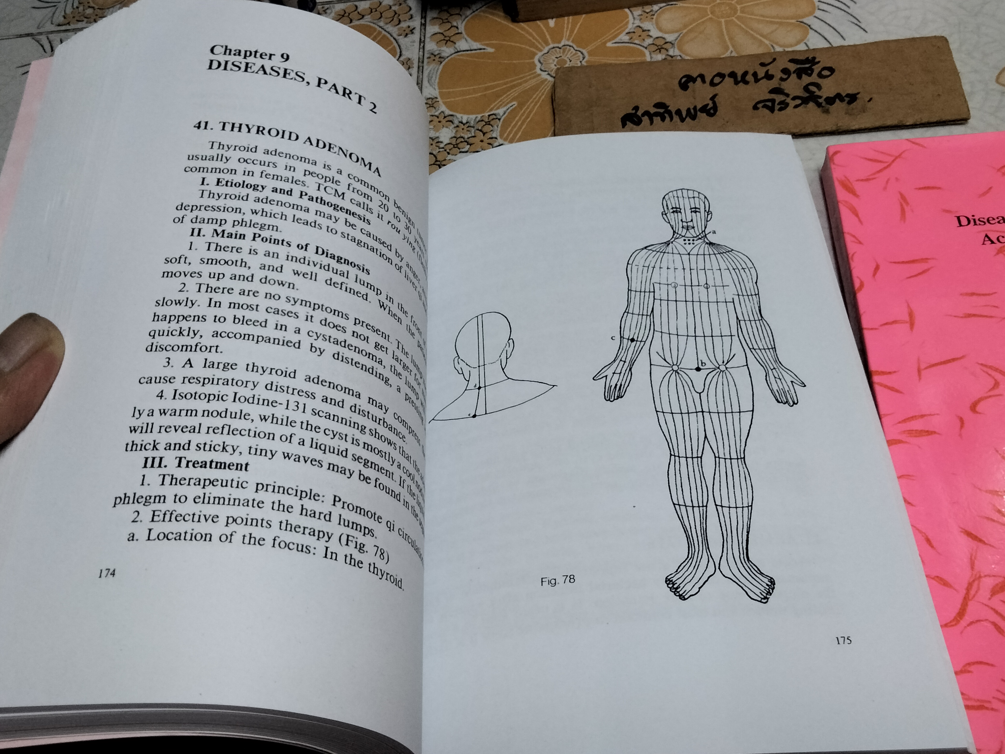 หนังสือเกี่ยวกับการแพทย์แผนจีน- การฝังเข็ม (ภาษาอังกฤษ /ฉบับถ่ายเอกสาร) Effective Points Therapy of Acupuncture , Mao Qunhui + 100 Diseases Treated by Single Point of Acupuncture and Moxibustion , Chen Decheng **สินค้าหมด**