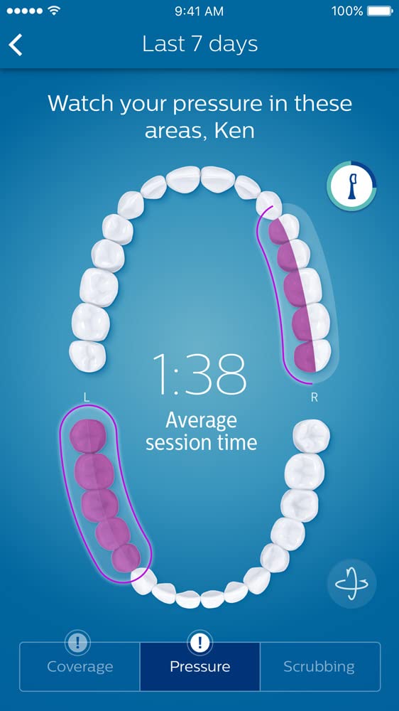 Philips® Sonicare 9500 Diamond Clean Smart Power Toothbrush ฟิลิปส์ แปรงสีฟันไฟฟ้า