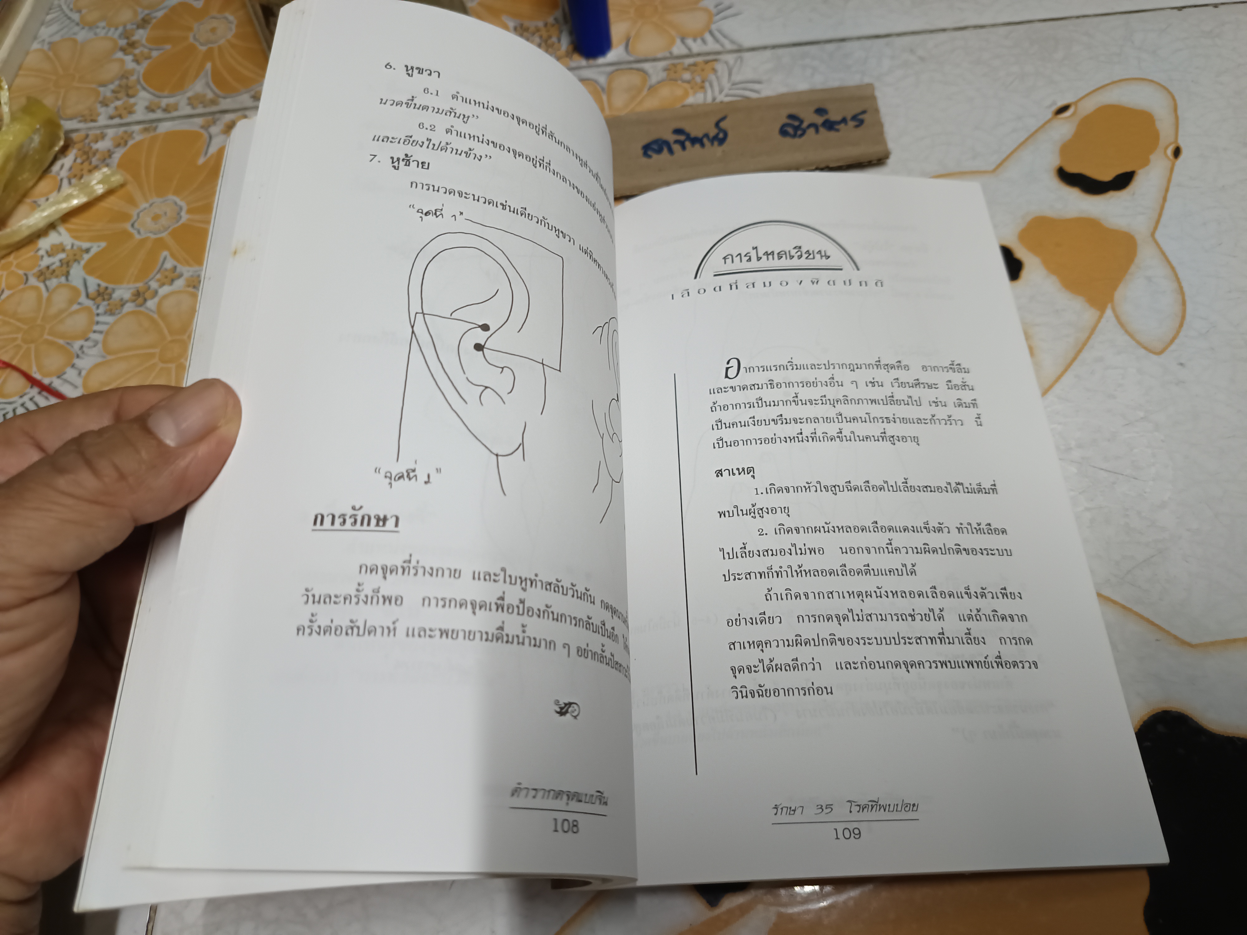 ตำรากดจุดแบบจีนรักษา 35 โรคที่พบบ่อย