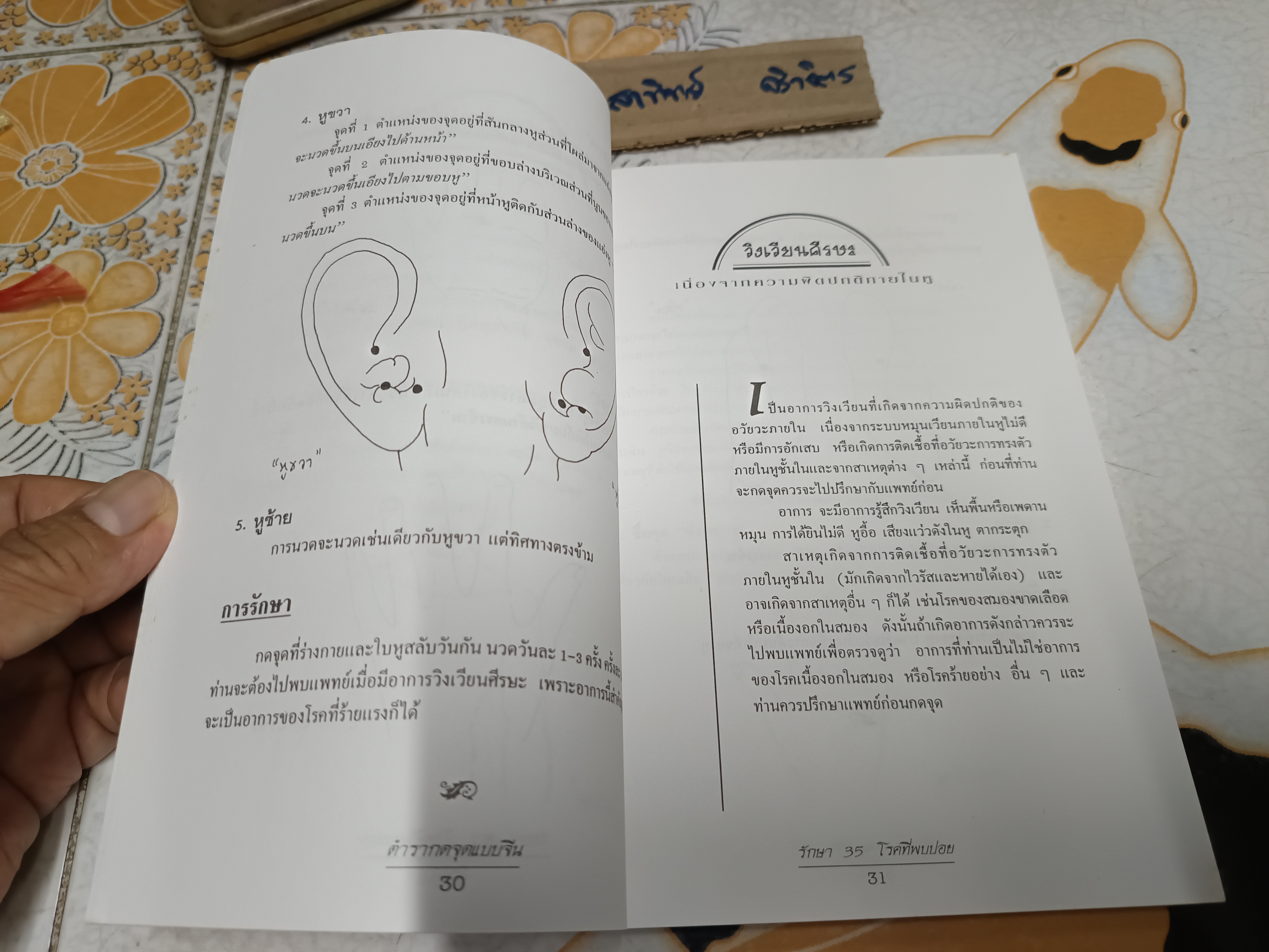 ตำรากดจุดแบบจีนรักษา 35 โรคที่พบบ่อย