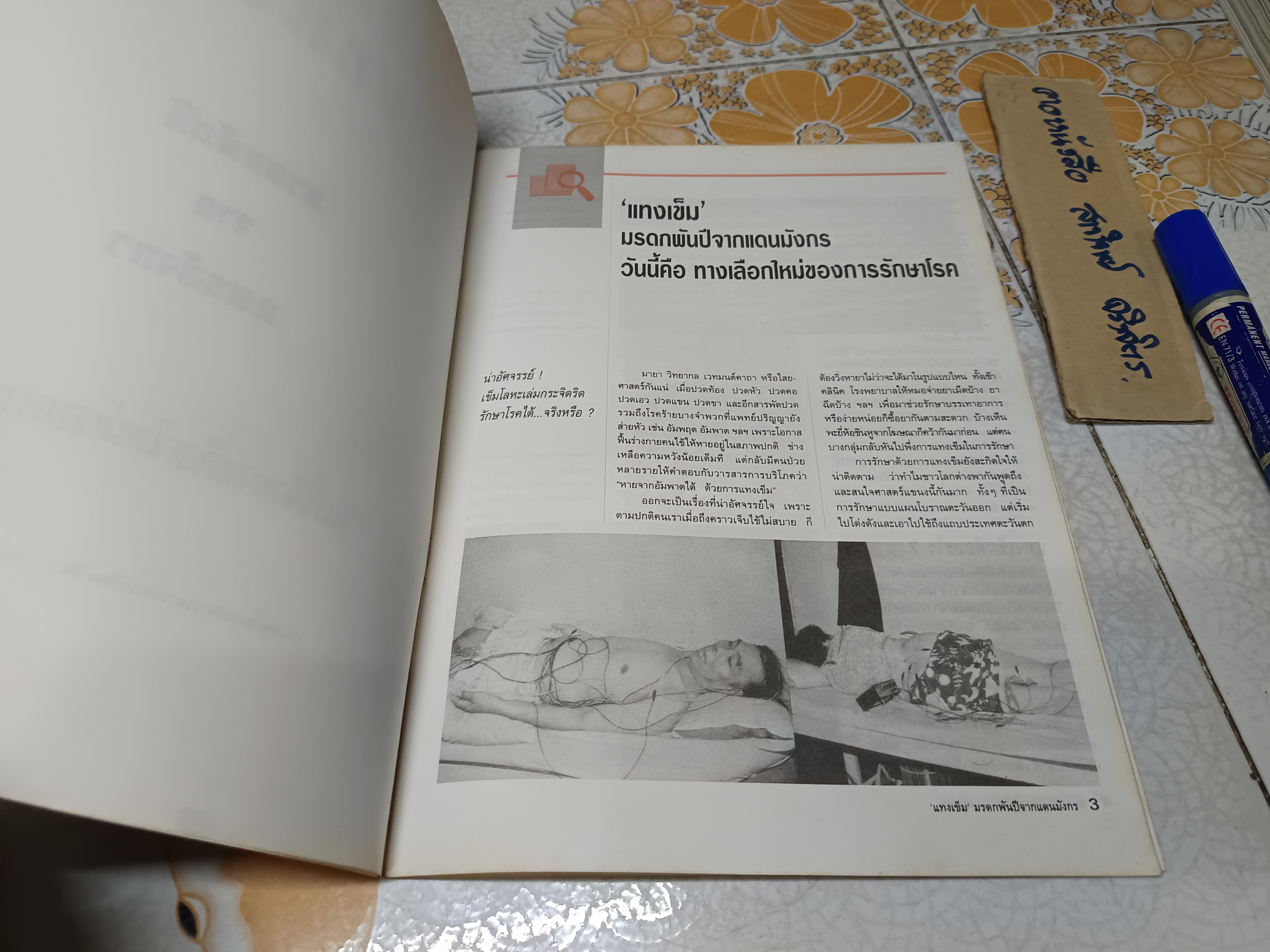 แทงเข็ม - มรดกพันปีจากแดนมังกร พิมพ์ครั้งแรก ในวารสารการบริโภค ปีที่ 1 ฉบับที่ 7 มิถุนายน- กรกฎาคม 2537