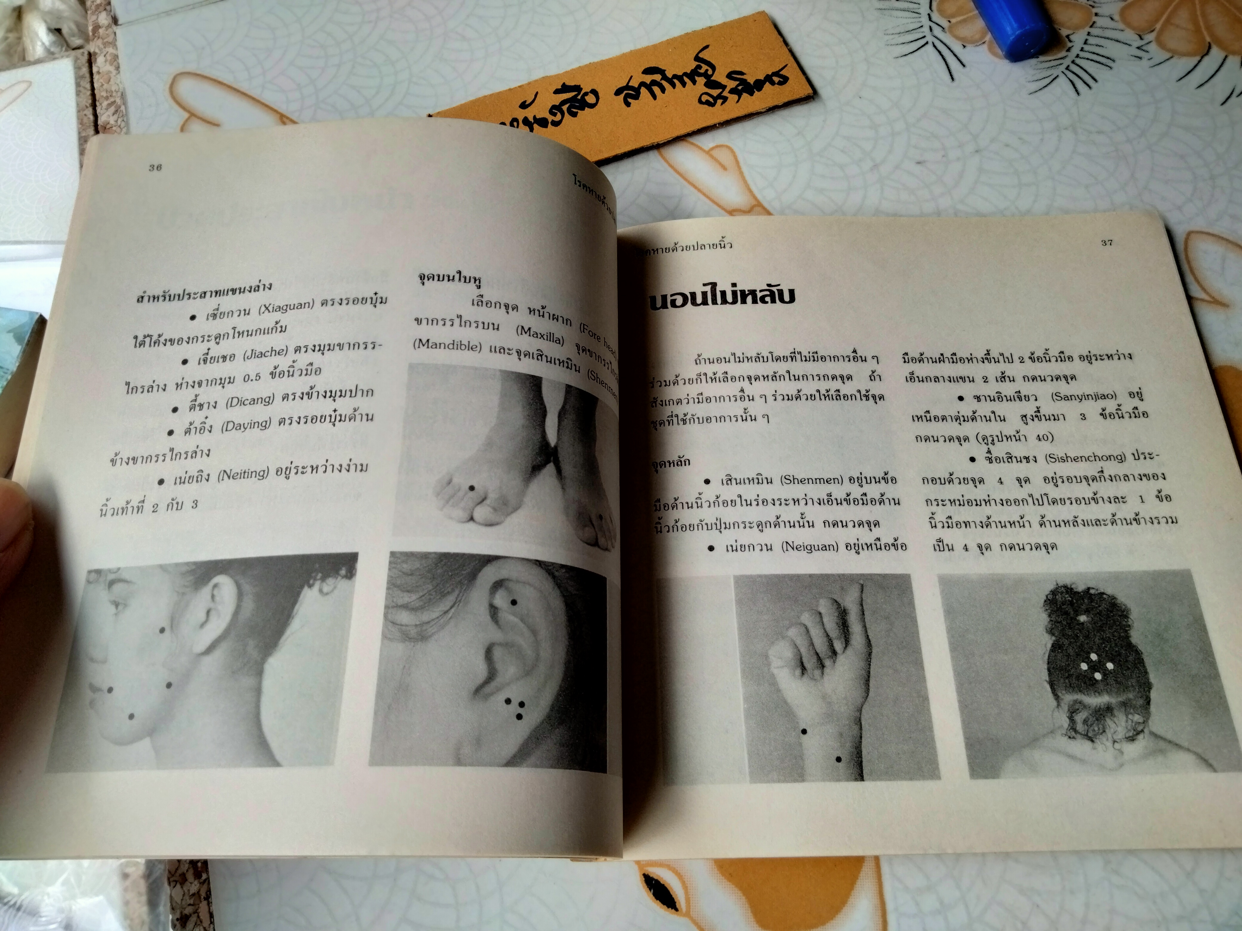 โรคหายด้วยปลายนิ้ว พญ.ณัฏฐา ชุณหสวัสดิกุล , นพ.บรรจบ ชุณหสวัสดิกุล พิมพ์ครั้งที่ 5/2531