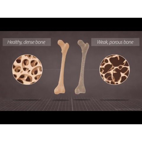 Doctor's Best® Natural Vitamin K2 MK-7 with MenaQ7® 100 mcg* 60 Veggie Caps ลดกระดูกพรุน ช่วยระะบบหลอดเลือด