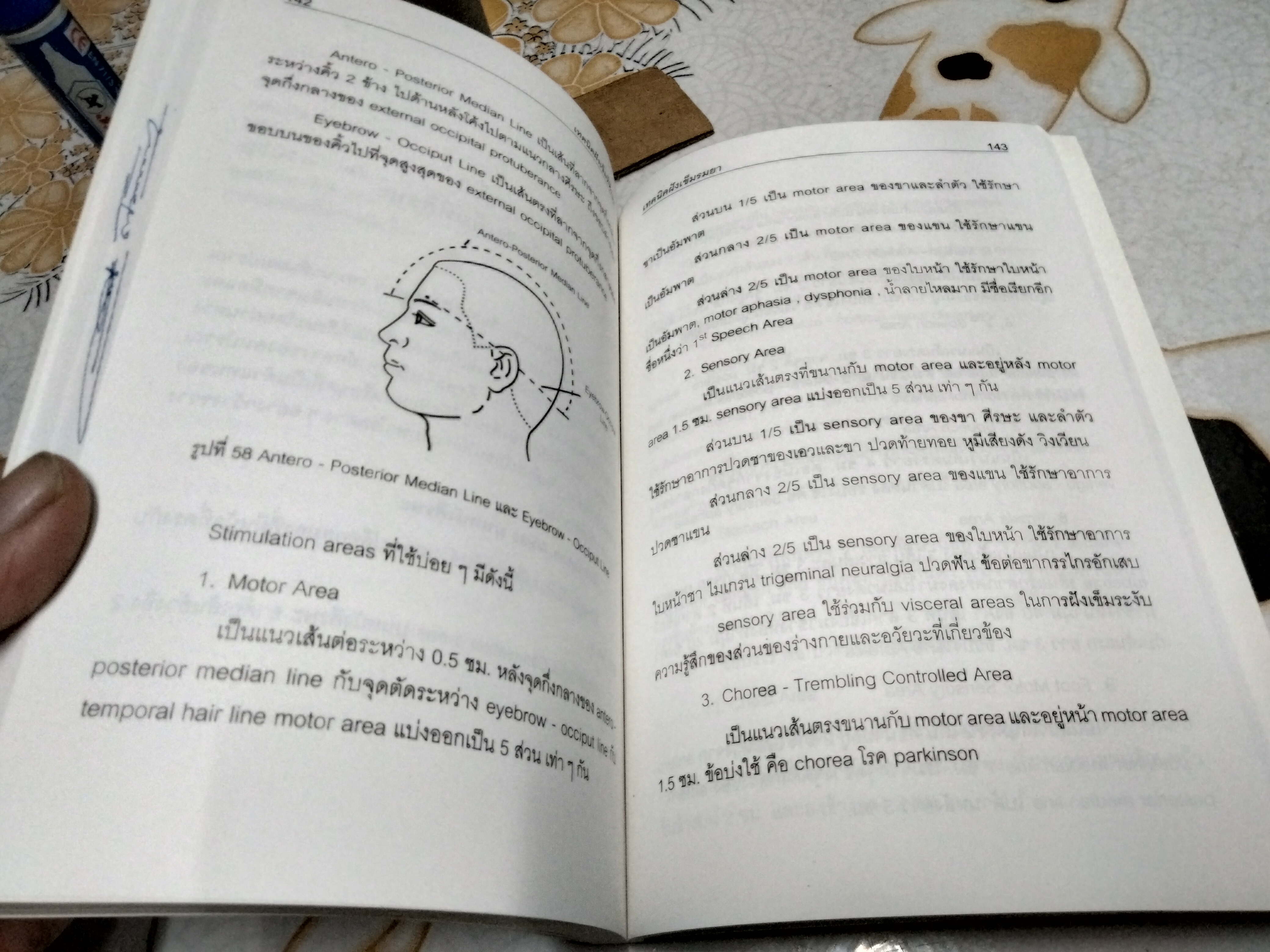 เทคนิคฝังเข็มรมยา : ตำราเรียนการแพทย์แผนจีนด้วยตนเอง ผู้แต่ง : โกวิท คัมภีรภาพ พิมพ์ครั้งแรก พ.ศ.2547 **สินค้าหมด**