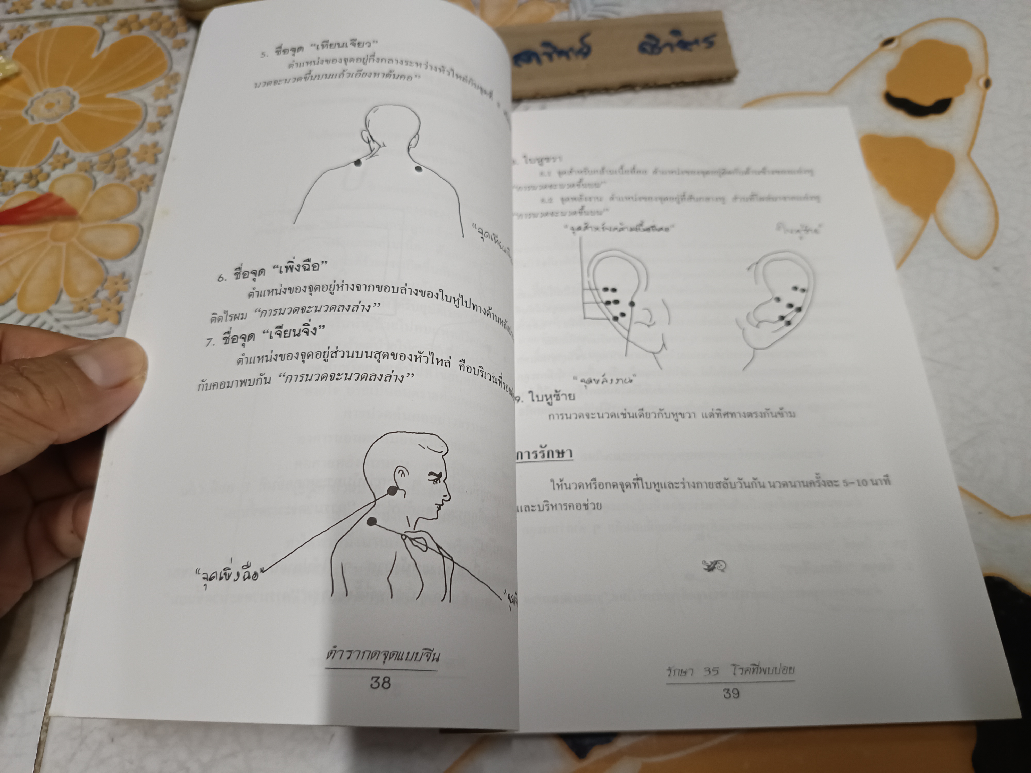 ตำรากดจุดแบบจีนรักษา 35 โรคที่พบบ่อย