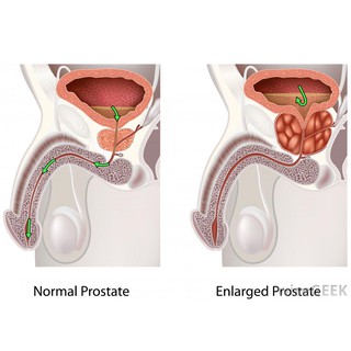 21st Century® Saw Palmetto 450 mg สารสกัดซอว์ปาลเมตโต้