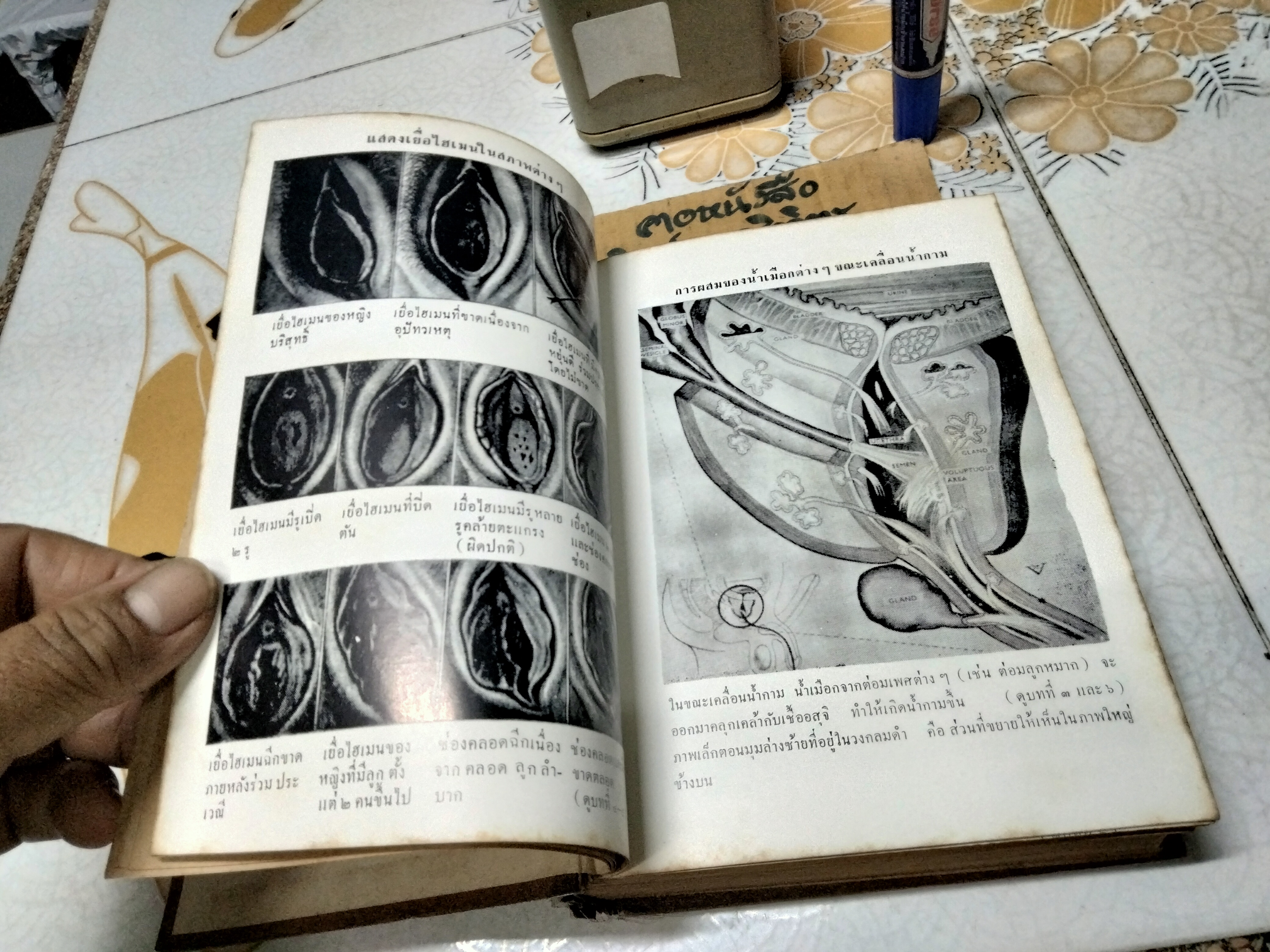 ไขปัญหา ความลับระหว่างเพศ โดย นายแพทย์บุตร ประดิษฐวณิช พิมพ์ปีพ.ศ 2504 สำนักพิมพ์ผดุงศึกษา **สินค้าหมด**