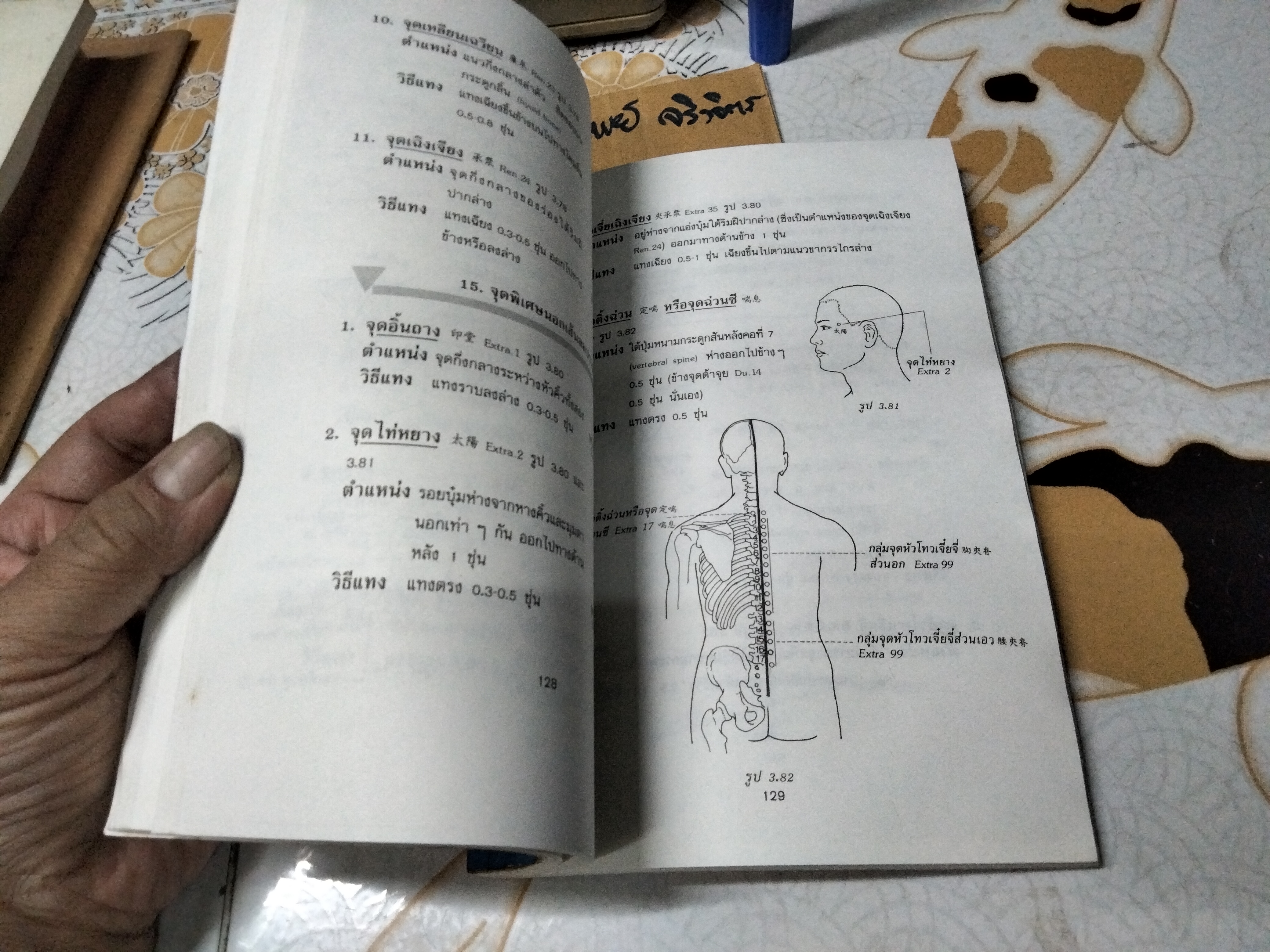 แทงเข็ม - คู่มือพื้นฐานการแทงเข็ม โดย อภิชัย ชัยดรุณ , วิทวัส วัณนาวิบูล และ เผด็จ เอี่ยมแสงธรรม พิมพ์ครั้งแรก พ.ศ 2532 สนพ.ยินหยาง **สินค้าหมด**