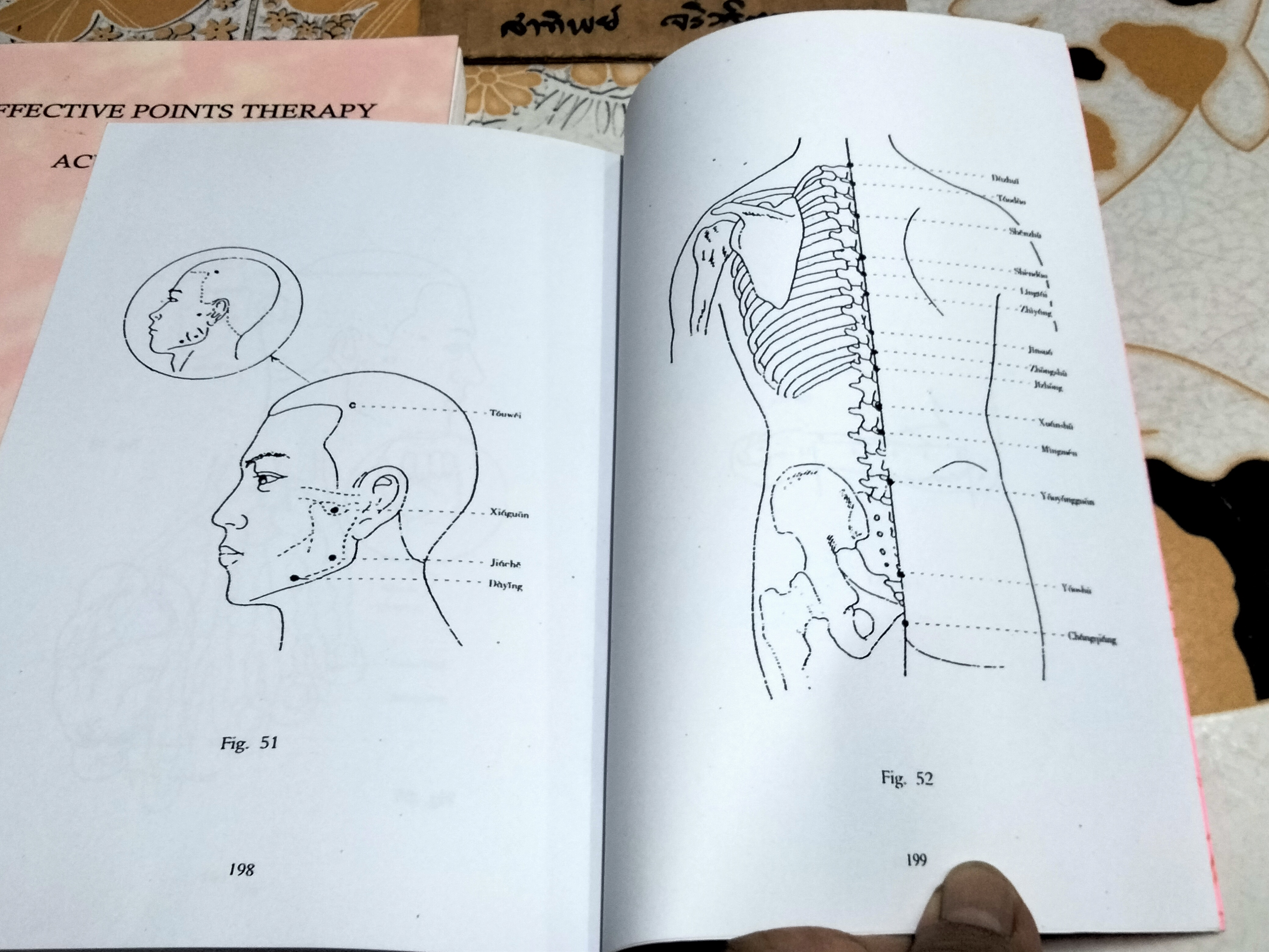 หนังสือเกี่ยวกับการแพทย์แผนจีน- การฝังเข็ม (ภาษาอังกฤษ /ฉบับถ่ายเอกสาร) Effective Points Therapy of Acupuncture , Mao Qunhui + 100 Diseases Treated by Single Point of Acupuncture and Moxibustion , Chen Decheng **สินค้าหมด**