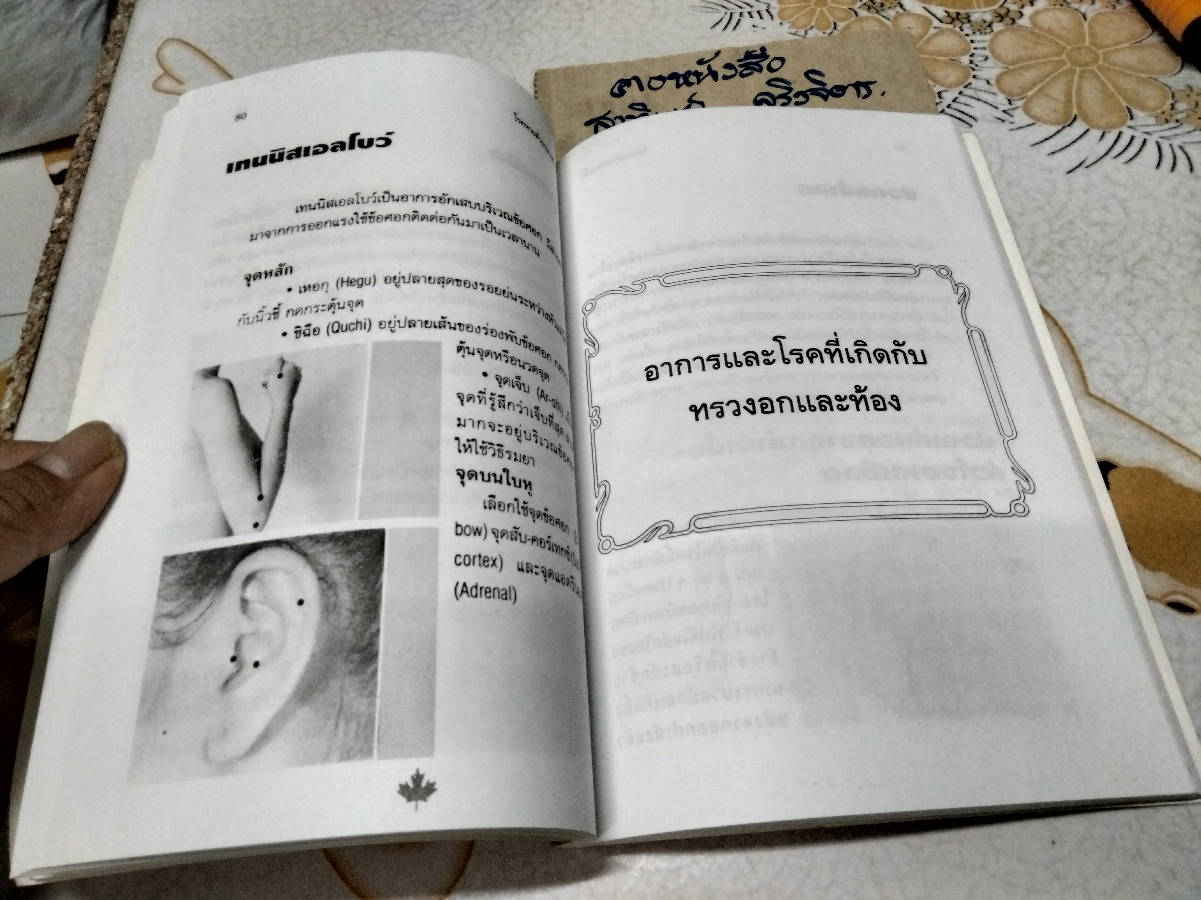 โรคหายด้วยปลายนิ้ว พญ.ณัฏฐา ชุณหสวัสดิกุล , นพ.บรรจบ ชุณหสวัสดิกุล