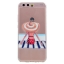 Case Huawei P10 #เคสฝาหลังพิมพ์ลาย TPU นิ่มบางนุ่มลายแฟชั่นน่ารัก